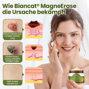 Biancat® MagneErase Renewal Cream