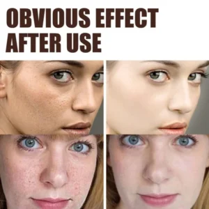 Tiworld® Anti-wrinkle cream