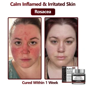 LEFUN KeraErase Dual-Action Renewal Cream