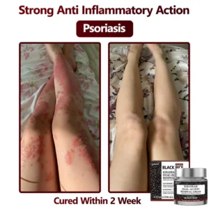 LEFUN KeraErase Dual-Action Renewal Cream