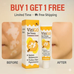 VitiGO™ Vitiligo Skin Repair Cream