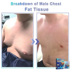 GFOUK® NanoMedix Gynecomastia Chest Fatburn & Firm Patch 8 GFOUK® NanoMedix Gynecomastia Chest Fatburn & Firm Patch