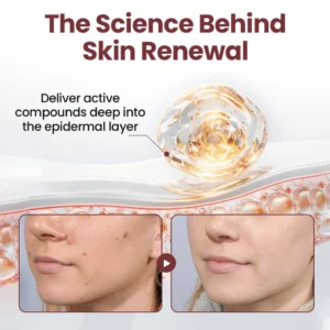 Seurico™KeraErase Dual-Action Renewal Cream