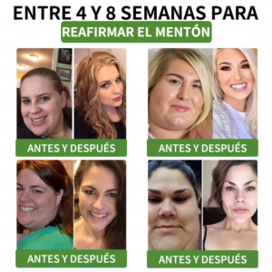 Risarisa® BERBERINE Nano Patch Solution A comprehensive 7 Risarisa® BERBERINE Nano Patch Solution A comprehensive