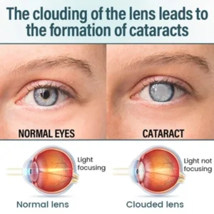 Reclaim Your Crystal-Clear Vision with Elycura™ NANO Eye Drops 8 Reclaim Your Crystal-Clear Vision with Elycura™ NANO Eye Drops