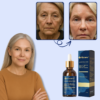 Elycura™ Lift Serum | Lift your face in 1 week without Botox 13 Elycura™ Lift Serum | Lift your face in 1 week without Botox