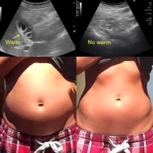 BIOCLEANSE® New Maximum Potency Formula 10 BIOCLEANSE® New Maximum Potency Formula