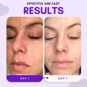 AEXZR® Thiamidol 630 Serum