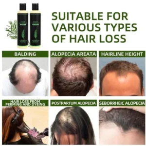 Cvreoz Organic Rosemary Hair Growth Shampoo