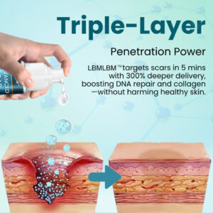 LBMLBM® Advanced Medical Grade Silicone Scar Gel 11 LBMLBM® Advanced Medical Grade Silicone Scar Gel