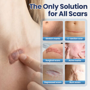 TAILEDEN® Texture Repair Gel 10 TAILEDEN® Texture Repair Gel