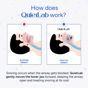 QuietLab Pro® Adjustable Anti-Snoring Mouthpiece 9 QuietLab Pro® Adjustable Anti-Snoring Mouthpiece
