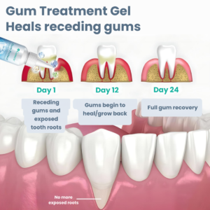 Gumex™ Gum Repair Gel 9 Gumex™ Gum Repair Gel