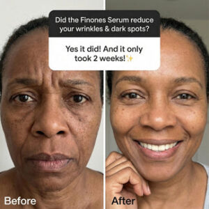 Finones™ Skin Vitamin Serum 9 Finones™ Skin Vitamin Serum