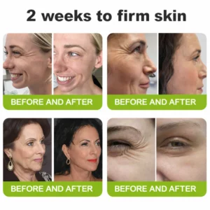 LBMLBM® Botox & Vita-A Retinol Shot Wrinkle-Lift Tightening cream 7 LBMLBM® Botox & Vita-A Retinol Shot Wrinkle-Lift Tightening cream