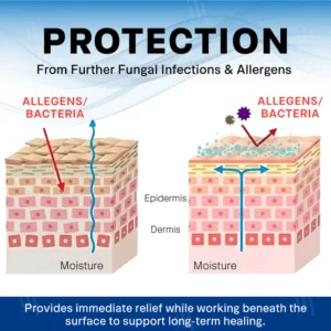 Alisanda® Scrotum Itchy Treatment Cream 9 Alisanda® Scrotum Itchy Treatment Cream