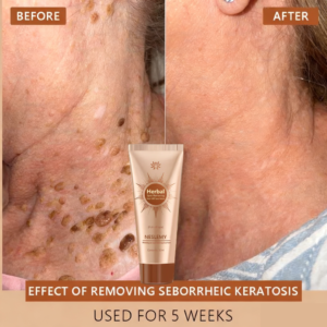 NESLEMY™ Whitening and Spot-Removing Face Mask 9 NESLEMY™ Whitening and Spot-Removing Face Mask