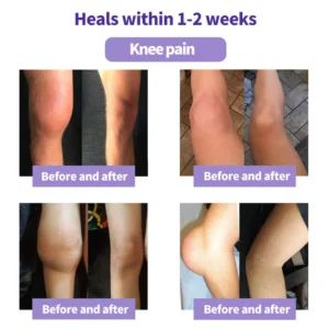 SEAGRIL™ Turmeric & Emu Oil Arthritis Soothing Pain Relief Massage Gel 8 SEAGRIL™ Turmeric & Emu Oil Arthritis Soothing Pain Relief Massage Gel