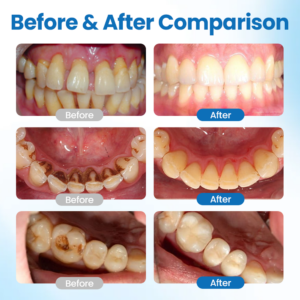 Smileasego™ NanoHAP Tooth Defense Serum 10 Smileasego™ NanoHAP Tooth Defense Serum