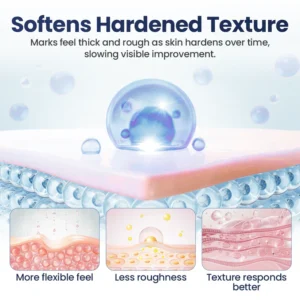 Blizkox® Texture Repair Gel — Restore Smooth, Even-Looking Skin Naturally 10 Blizkox® Texture Repair Gel — Restore Smooth, Even-Looking Skin Naturally