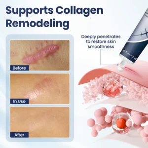 Blizkox® Texture Repair Gel — Restore Smooth, Even-Looking Skin Naturally 9 Blizkox® Texture Repair Gel — Restore Smooth, Even-Looking Skin Naturally