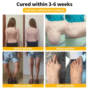 LOVILDS® Bee Venom Bone Care Creamn 7 LOVILDS® Bee Venom Bone Care Creamn