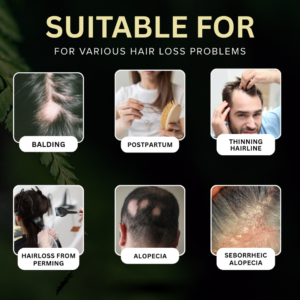 AEXZR® Non-Minoxidil Scalp Recovery 11 AEXZR® Non-Minoxidil Scalp Recovery