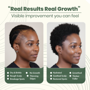 LBMLBM™ Batana Natural Hair Growth Oil 9 LBMLBM™ Batana Natural Hair Growth Oil