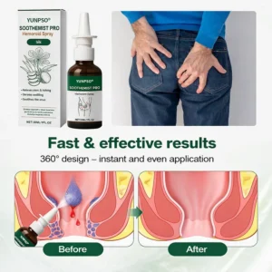 YUNPSO® SootheMist PRO Hemorrhoid Spray 7 YUNPSO® SootheMist PRO Hemorrhoid Spray