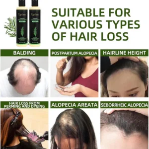 Tgideas Rosemary Shampoo 7 Tgideas Rosemary Shampoo